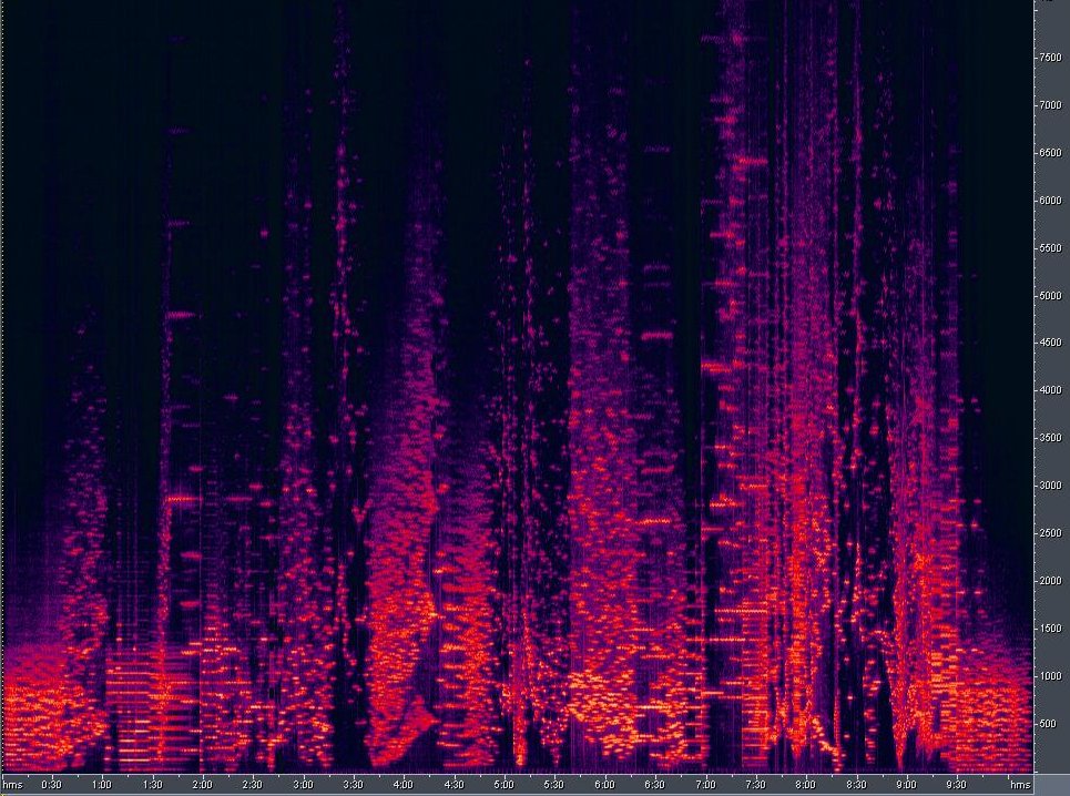 wires sonogram